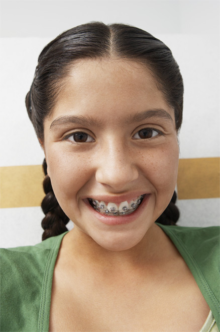 orthodontic treatments