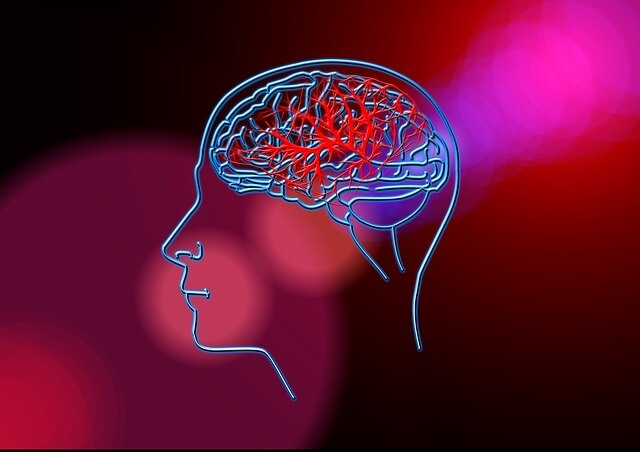 Brain Stem Stroke