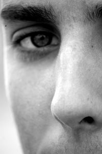 non surgical nose job results non surgical nose job results