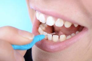 How do you floss a dental bridge