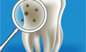 black spots on teeth animation