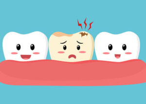 Tooth cavities