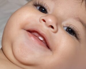 teeth-eruption-problems