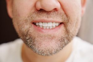 dental checkup dark stains